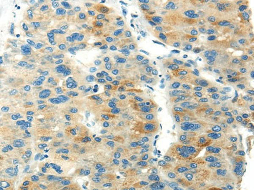 Anti-Human PDPN Antibody - ABMIUM