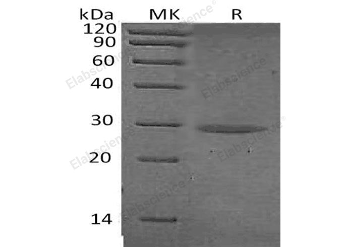 Recombinant Human Chymotrypsinogen B/CTRB1 Protein (His Tag) - ABMIUM