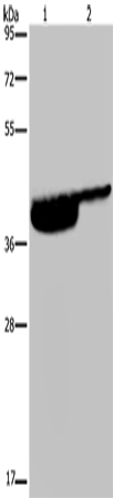 Anti-Human P2RX3 Antibody - ABMIUM