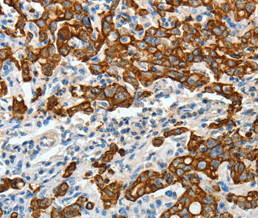 Anti-Human/Mouse/Rat KRT18 Antibody - ABMIUM