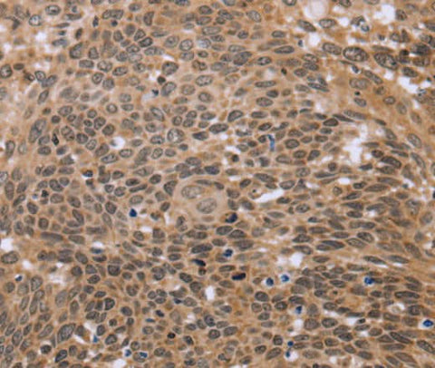 Anti-Human ERCC6L Antibody - ABMIUM