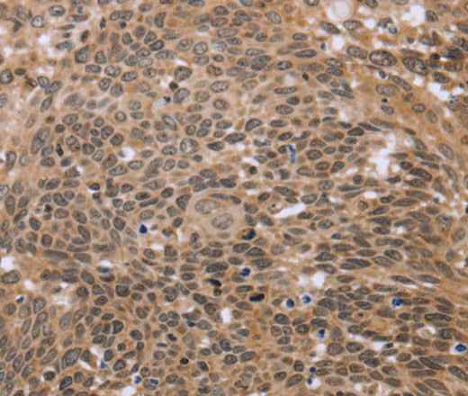 Anti-Human ERCC6L Antibody - ABMIUM