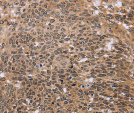 Anti-Human ERCC6L Antibody - ABMIUM