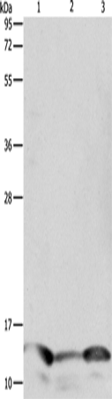 Anti-Human/Mouse/Rat PFN1 Antibody