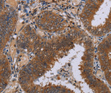Anti-Human/Mouse/Rat NPTX1 Antibody - ABMIUM