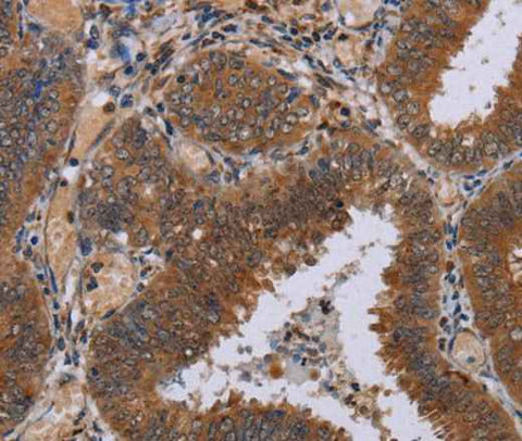 Anti-Human/Mouse/Rat NPTX1 Antibody