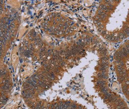 Anti-Human/Mouse/Rat NPTX1 Antibody