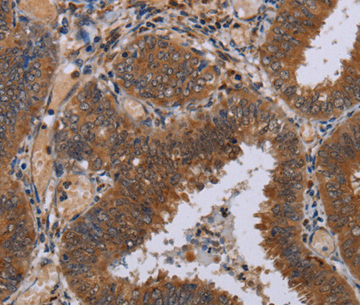 Anti-Human/Mouse/Rat NPTX1 Antibody - ABMIUM