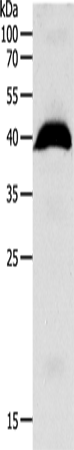 Anti-Human/Mouse/Rat OPRL1 Antibody - ABMIUM