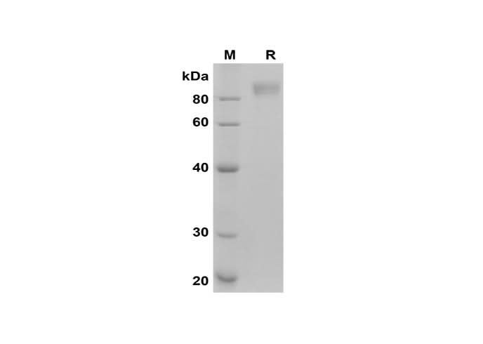 SDS-PAGE analysis of Human Fibronectin/FN proteins, 2 μg/lane of Recombinant Human Fibronectin/FN proteins was resolved with SDS-PAGE under reducing conditions, showing bands at 90 kDa.
