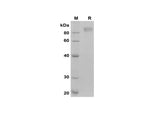 SDS-PAGE analysis of Human Fibronectin/FN proteins, 2 μg/lane of Recombinant Human Fibronectin/FN proteins was resolved with SDS-PAGE under reducing conditions, showing bands at 90 kDa.