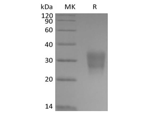 Recombinant Human Frizzled-8 (C-6His-Avi) Biotinylated - ABMIUM