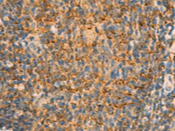 Anti-Human IFITM2 Antibody
