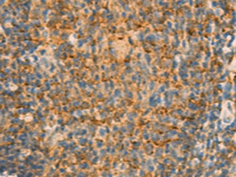 Immunohistochemistry of paraffin-embedded Human tonsil tissue using IFITM2 Polyclonal Antibody at dilution of 1:25(×200)