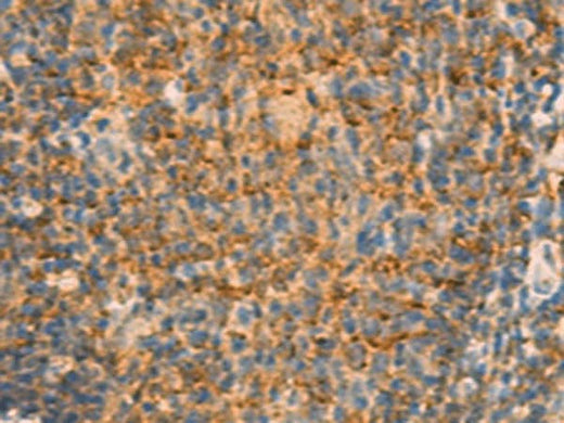 Immunohistochemistry of paraffin-embedded Human tonsil tissue using IFITM2 Polyclonal Antibody at dilution of 1:25(×200)