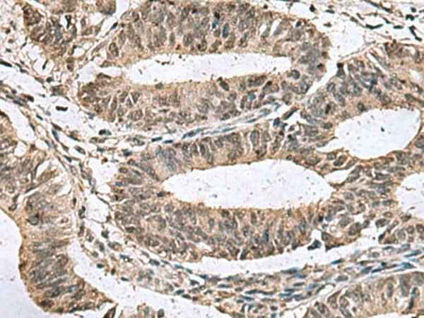 Anti-Human/Mouse TMX3 Antibody