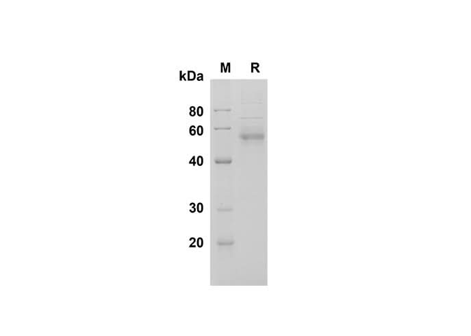 SDS-PAGE analysis of Human Fetuin B proteins , 2 μg/lane of Recombinant Human Fetuin B proteins was resolved with SDS-PAGE under reducing conditions , showing bands at 55 kDa.