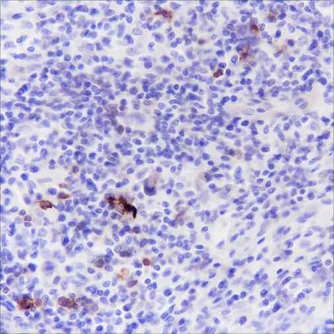 Anti-Human CD134/OX40 Antibody [A157] - ABMIUM