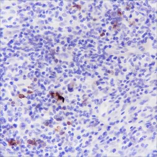 Anti-Human CD134/OX40 Antibody [A157] - ABMIUM