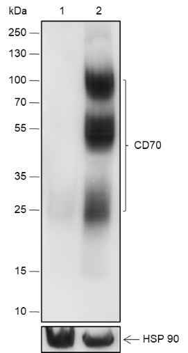 Anti-Human CD70 Antibody [A550] - ABMIUM