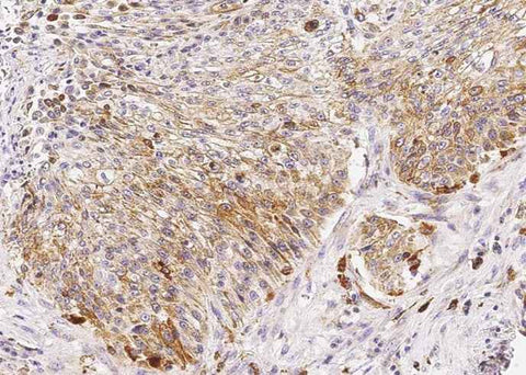 Anti-Human CTSD Antibody [B349] - ABMIUM