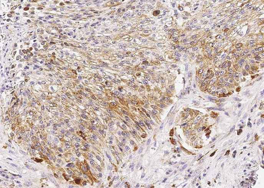 Anti-Human CTSD Antibody [B349] - ABMIUM