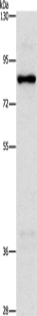 Anti-Human NOL9 Antibody - ABMIUM