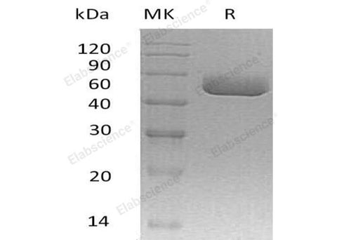Recombinant Mouse Serpina A1a Protein (His Tag) - ABMIUM
