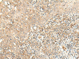 Anti-Human/Mouse MOB3B Antibody - ABMIUM