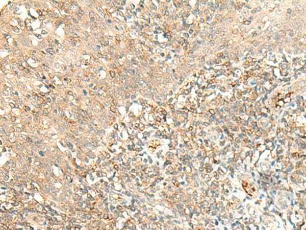 Anti-Human/Mouse MOB3B Antibody