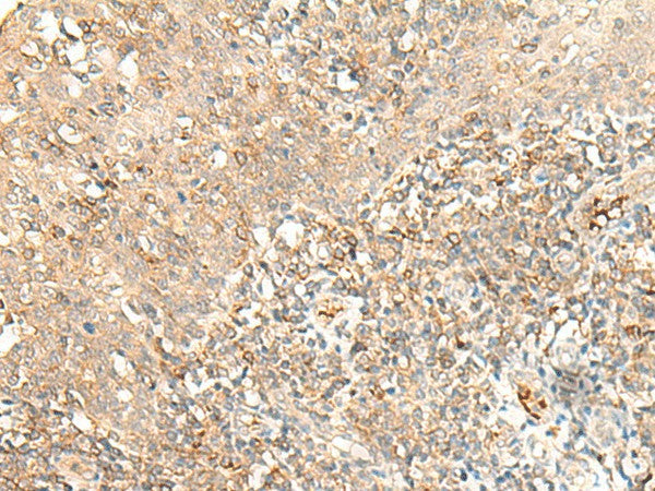 Anti-Human/Mouse MOB3B Antibody - ABMIUM
