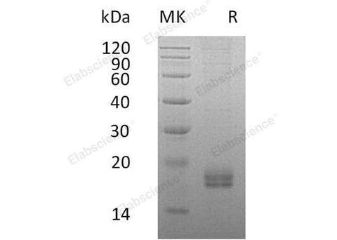 Recombinant Human CCL24/Eotaxin-2 Protein (His Tag) - ABMIUM