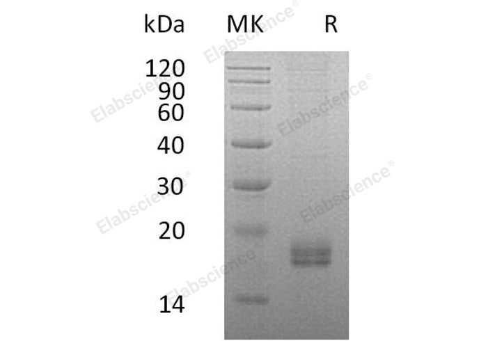 Recombinant Human CCL24/Eotaxin-2 Protein (His Tag) - ABMIUM