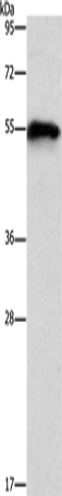 Anti-Human/Mouse CDK19 Antibody - ABMIUM