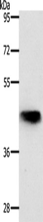 Anti-Human/Mouse/Rat NKX2-1 Antibody - ABMIUM