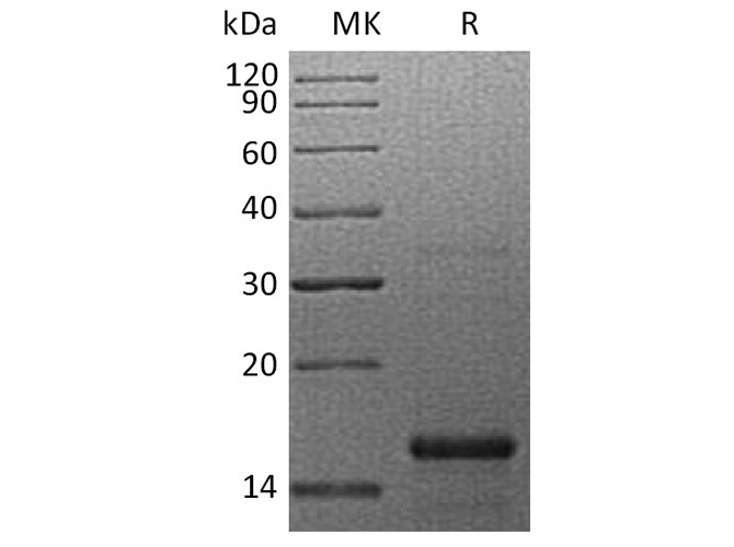 Recombinant Human GFER Protein (His Tag) - ABMIUM