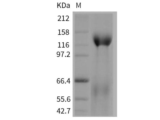 > 85 % as determined by reducing SDS-PAGE.