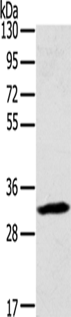 Anti-Human/Mouse STX11 Antibody - ABMIUM