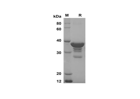 SDS-PAGE analysis of Human CXCL1 proteins, 2 μg/lane of Recombinant Human CXCL1 proteins was resolved with SDS-PAGE under reducing conditions, showing bands at 38 kDa.
