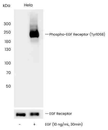 Anti-Human EGFR Antibody [A1119] - ABMIUM