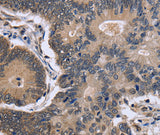 Anti-Human/Mouse/Rat FSTL1 Antibody - ABMIUM