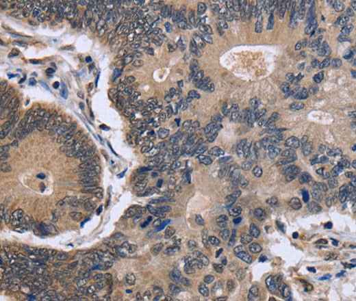 Anti-Human/Mouse/Rat FSTL1 Antibody