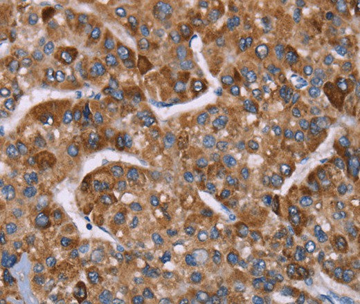 Anti-Human/Mouse/Rat HSP10 Antibody - ABMIUM
