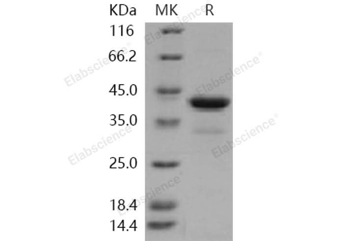 > 87 % as determined by reducing SDS-PAGE.