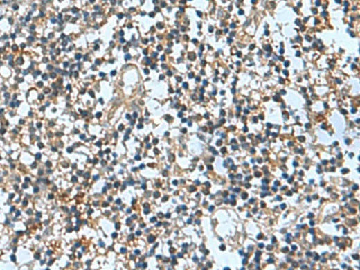 Immunohistochemistry of paraffin-embedded Human tonsil tissue using TRO Polyclonal Antibody at dilution of 1:65(×200)