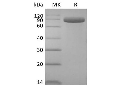 Recombinant Human Delta-like Protein 4/DLL4 (C-Fc) - ABMIUM