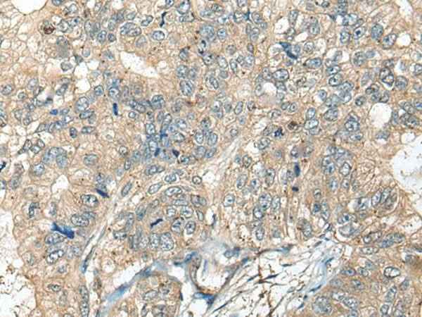 Anti-Human CASR Antibody