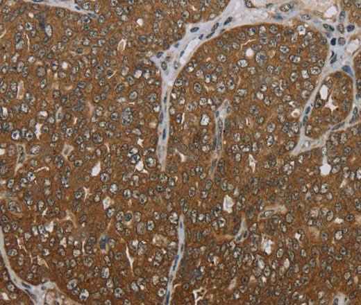 Anti-Human FOLH1B Antibody