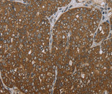 Anti-Human FOLH1B Antibody - ABMIUM
