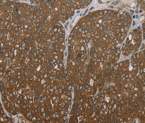 Anti-Human FOLH1B Antibody - ABMIUM